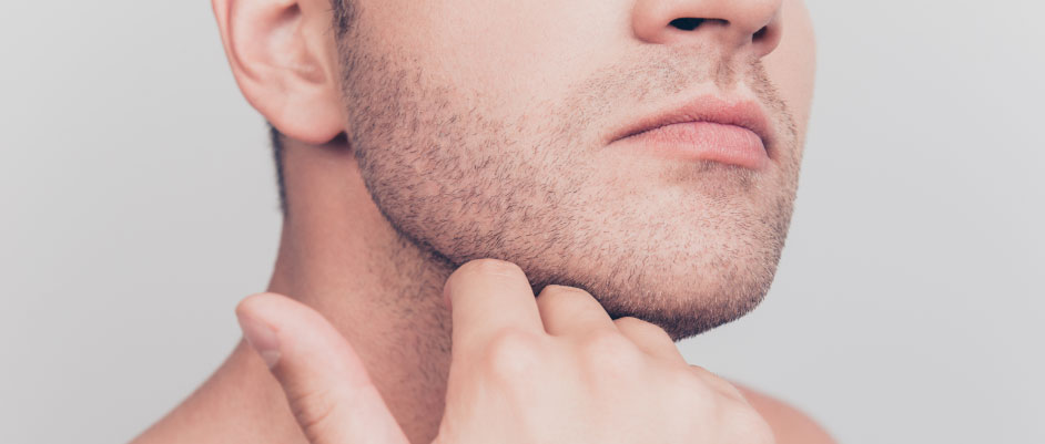 ヒゲ脱毛後に現れる泥棒ヒゲ！？どうして濃くなる？原因と対策