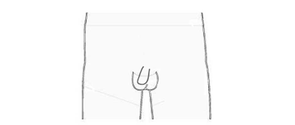 ハイジニーナ型