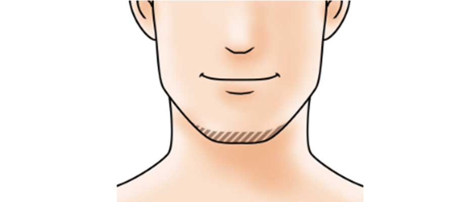 あごヒゲ 下部タイプ