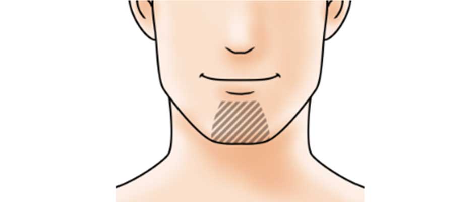 あごヒゲ 全体タイプ