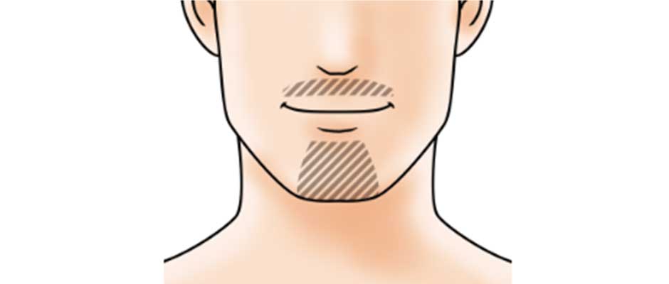 鼻下 + あごヒゲ セパレートタイプ