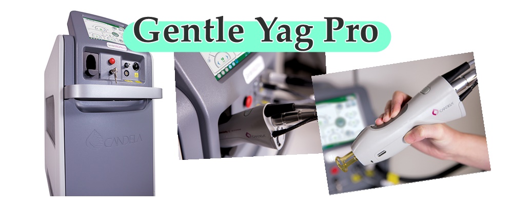 YAGレーザー脱毛機