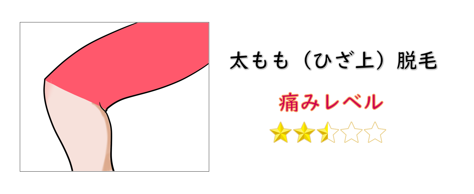 太もも脱毛の痛みレベル