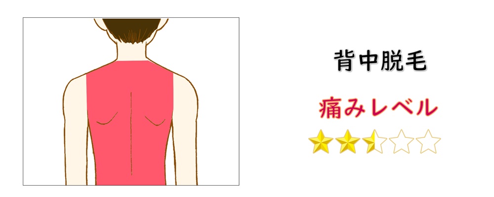 背中脱毛の痛みレベル
